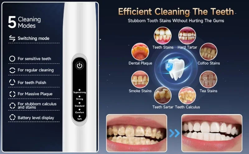 Pet Ultrasonic Teeth Cleaner – Electric Toothbrush for Dogs & Puppies | Oral Care & Grooming